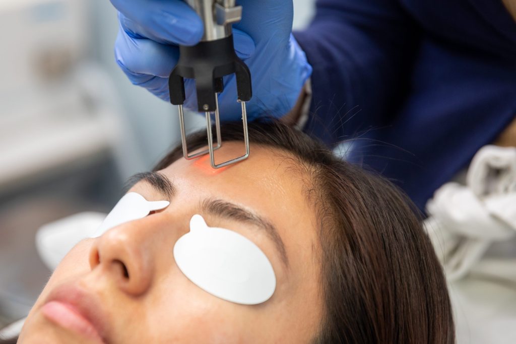 Cosmetic treatment session at Luxe Med Spa, featuring a practitioner using a device on a client's forehead, with protective eye pads in place, highlighting aesthetic procedures related to skincare and injectables.