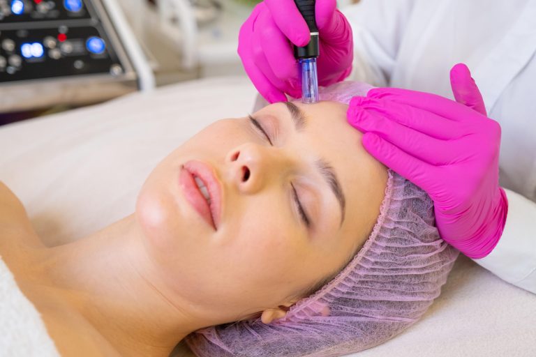 Microneedling in Yorba Linda
