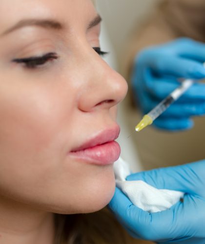 Chin Fillers