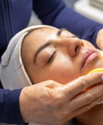 Microneedling Cost