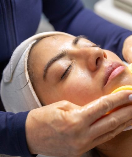Microneedling Cost