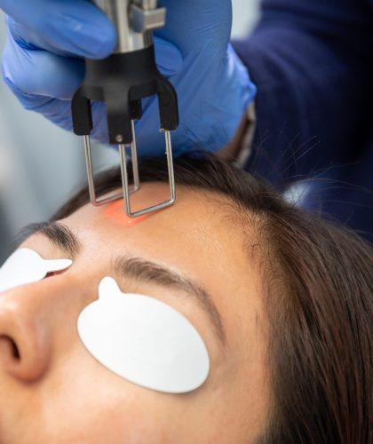 CO2 fractional laser