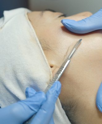 dermaplaning-treatment-2