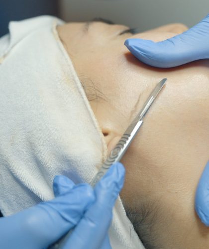 dermaplaning-treatment-2