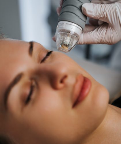 Microneedle RF lifting in a beauty salon. Big plan.